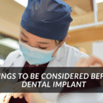 Things to be considerd before Dental implant