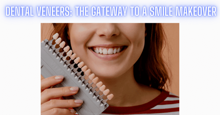 Dental Veneers The Gateway To A Smile Makeover