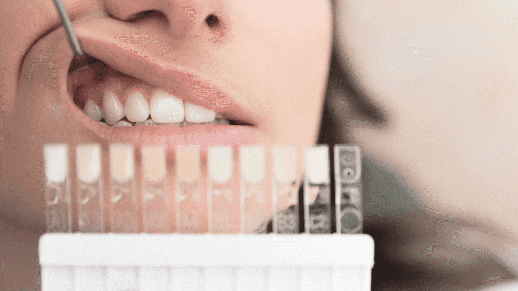 What is Cosmetic Dentistry