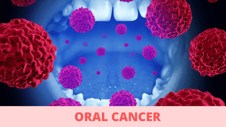 Oral Cancer: The Symptoms You Need to Know, and How to Prevent It