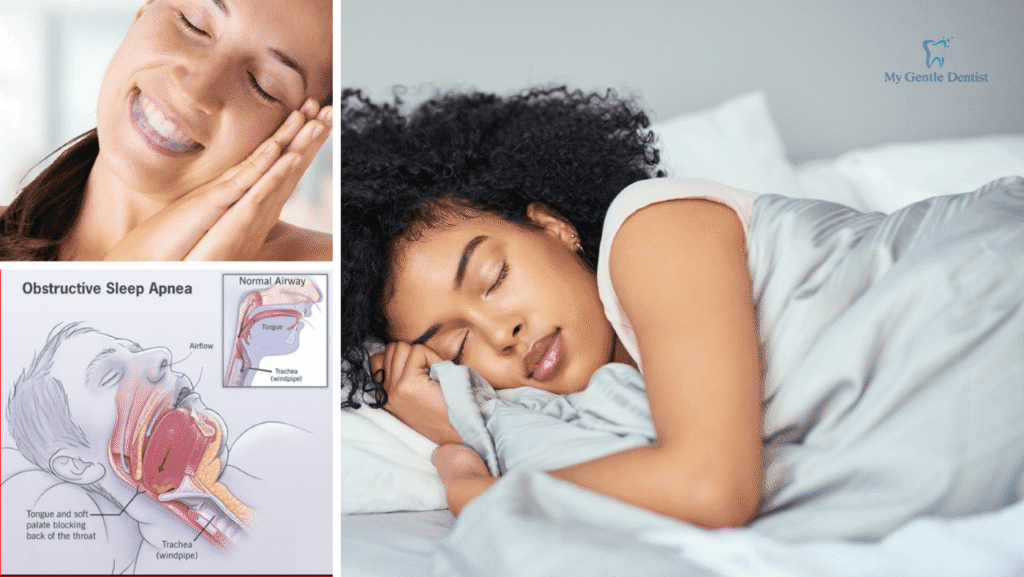 Reasons You Should Get a Night Mouth Guard to Protect Your Teeth