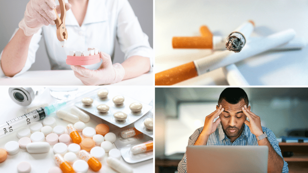 What are signs of severe Gum Disease?