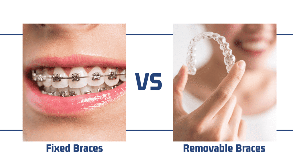 Removable Braces Have Their Pros and Cons, But How Do They Compare To Fixed Braces Removable Braces Have Their Pros and Cons, But How Do They Compare To Fixed Braces