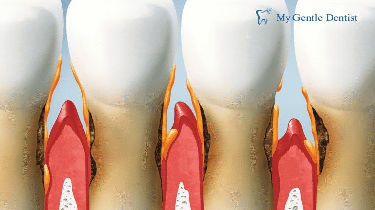 Periodontists Treatments