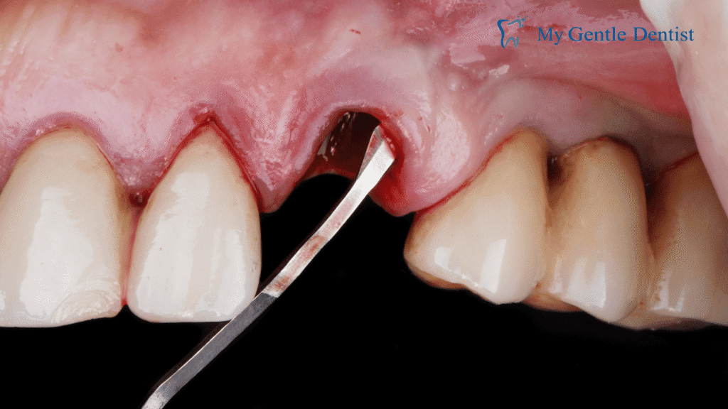 Top Periodontists Treatments for Gum Disease and Oral Health Top Periodontists Treatments for Gum Disease and Oral Health