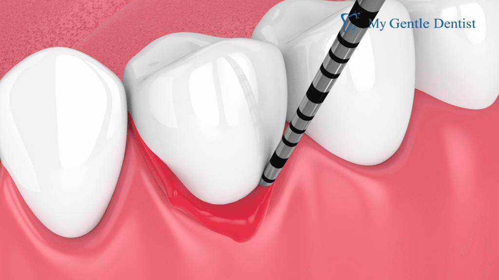 Top Periodontists Treatments for Gum Disease and Oral Health Top Periodontists Treatments for Gum Disease and Oral Health
