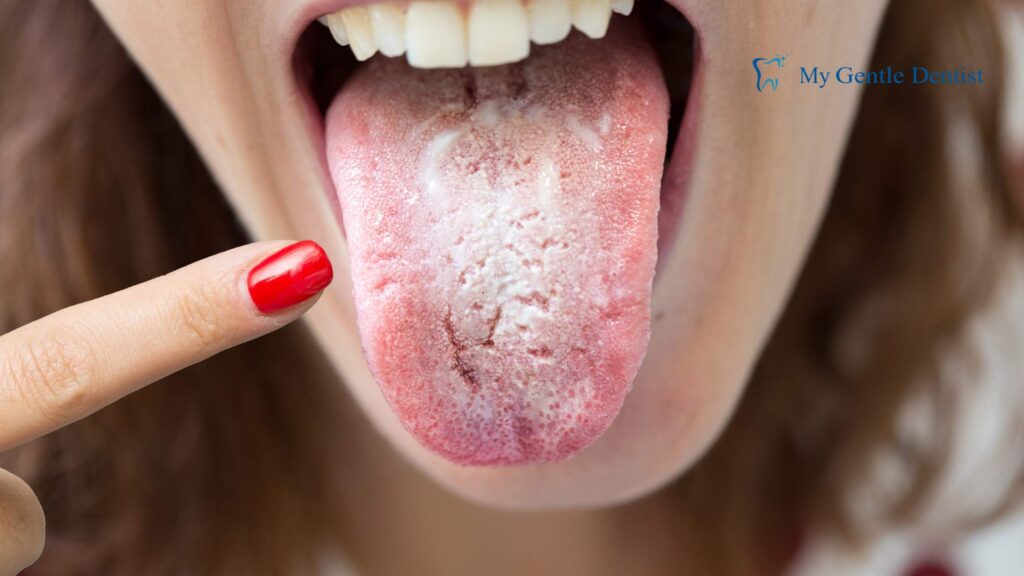 Bad Breath (Halitosis): Causes, Symptoms, and Effective Treatments Symptoms of Halitosis