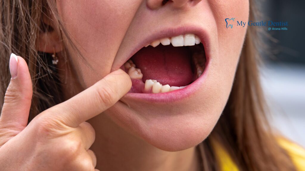 Why Seeing Periodontists Near Me Early Could Prevent Tooth Loss