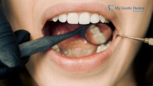 Wisdom Teeth Removal Cost