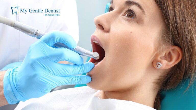 Root Canal