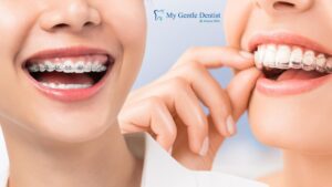Invisalign vs Braces: Which Is More Effective in 2025 Invisalign vs Braces
