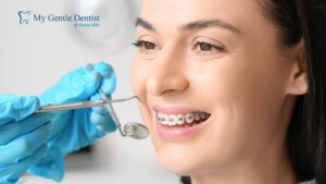 Invisalign vs Braces: Which Is More Effective in 2025 Braces