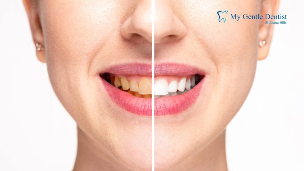 Cosmetic Dentist Near Me: Your Guide to a Radiant Smile in Arana Hills Benefits of a Cosmetic Makeover