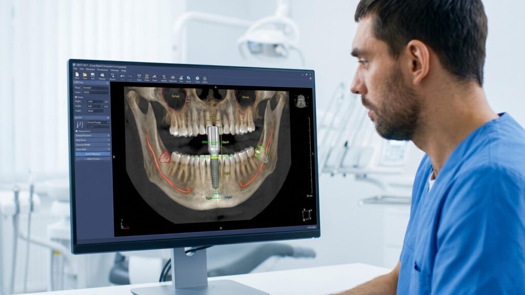 Decoding Implants Teeth Cost: Why Permanent Smiles Are the Ultimate Investment Implants Teeth Cost