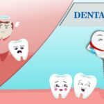 Top 5 Benefits of Dental Implants