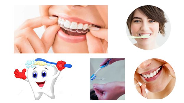 Invisalign before and after