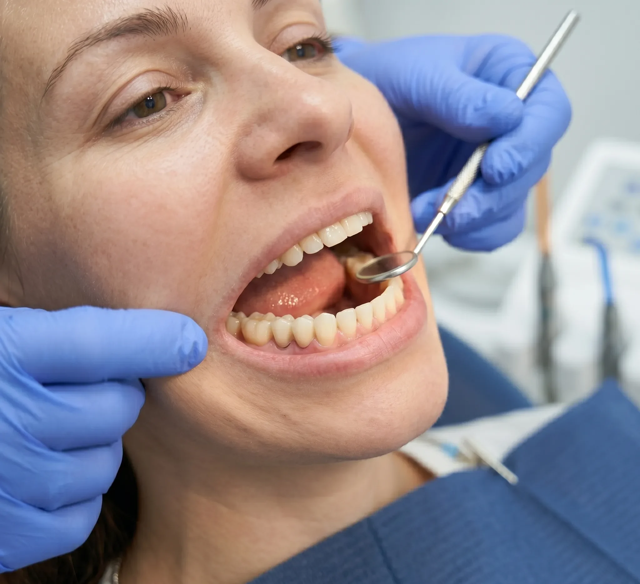 Fixed Teeth on Implants