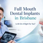 Dental Implants in Brisbane